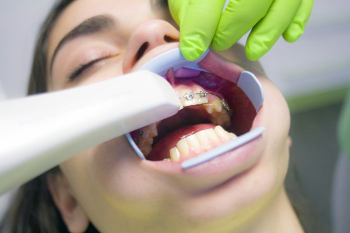 Zubní implantáty fotka